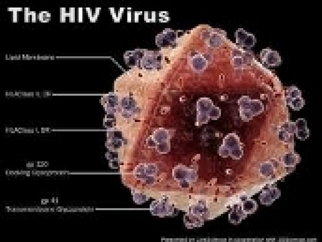 02-12-hivvirus_1322566500.jpg