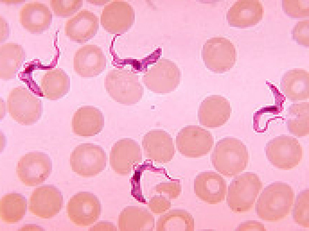 25-09-trypanosoma_1441721338.jpg